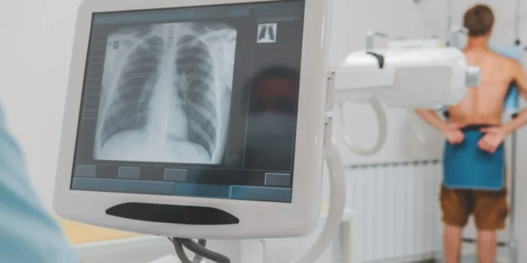 Do 2050. godine broj obolelih od raka će značajno porasti